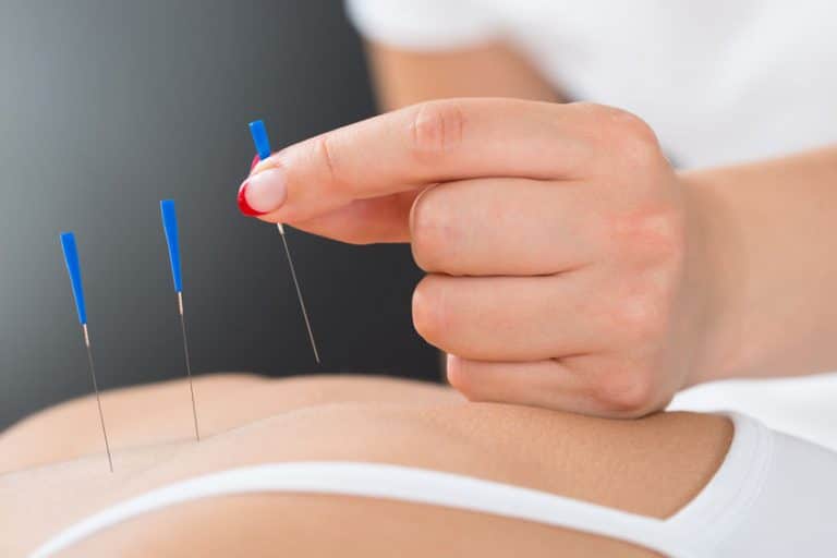 Image of a woman receiving acupuncture on her back as a treatment for chronic back pain.