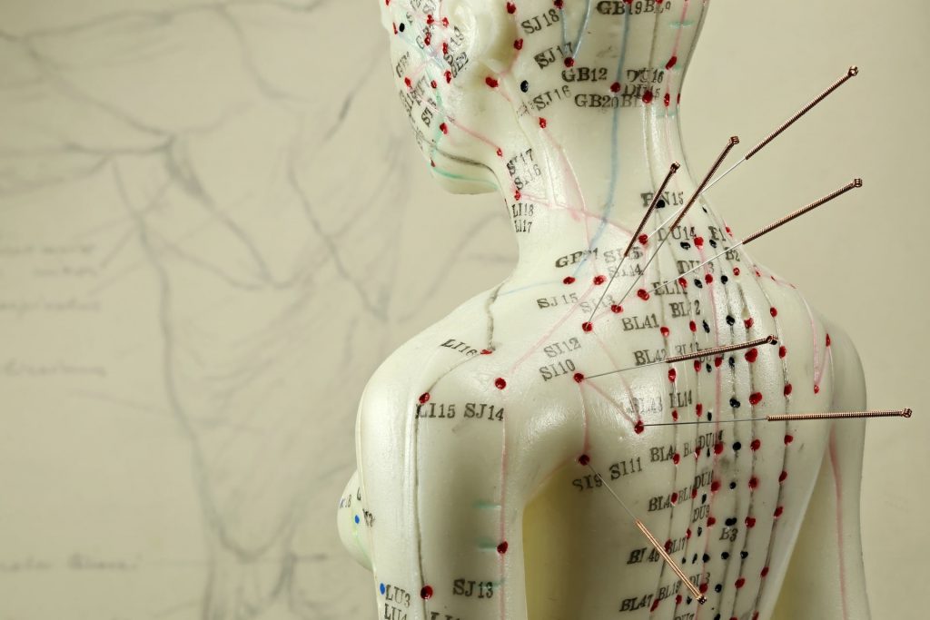 Acupuncture for Back Pain | Portland | Inner Works Acupuncture